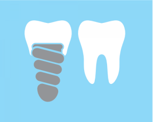 'dental implant vs. regular tooth'